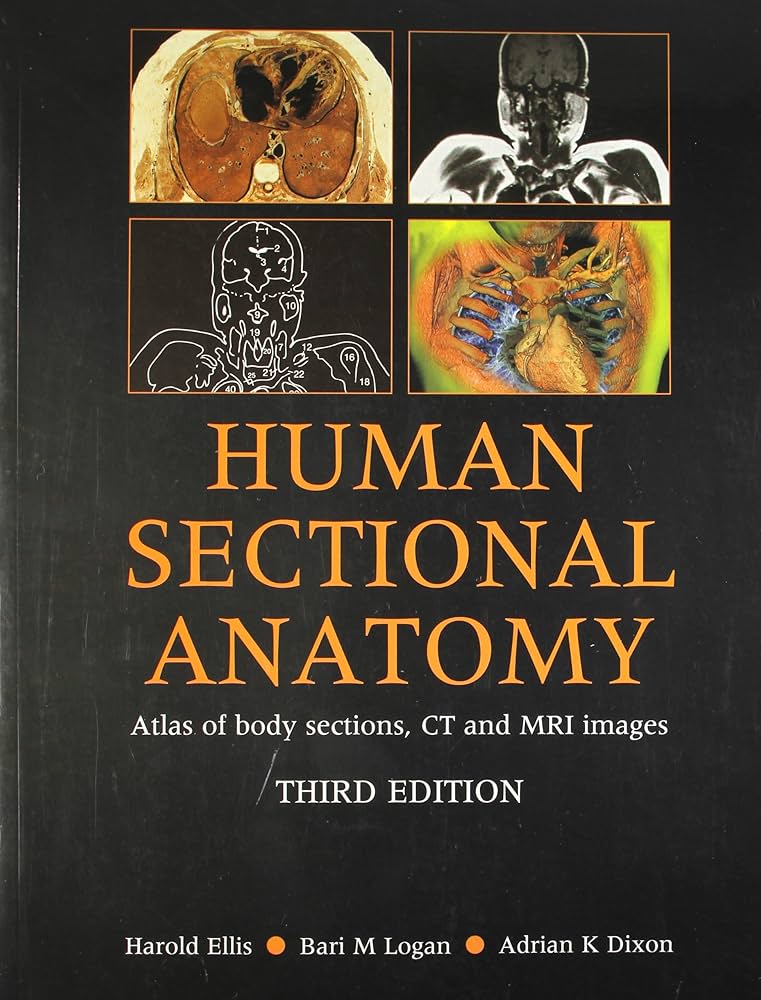 解剖学書籍 HUMAN CROSS-SECTIONAL ANATOMY 値下げ 解剖学書籍 HUMAN CROSS-SECTIONAL ANATOMY 値下げ Amazon.co.jp